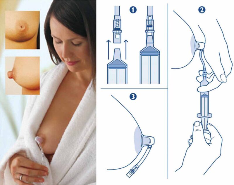 Avent Niplette Corector Pentru Mamelon, Corector, Set, 1buc-6204
