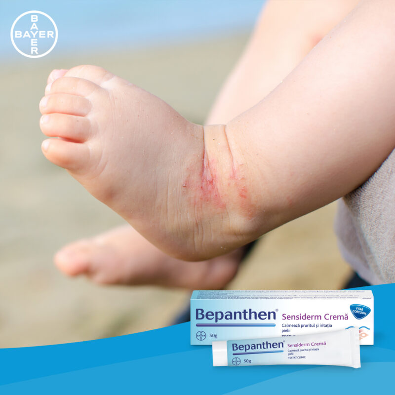 Bepanthen Sensiderm Crema 50 gr - calmeaza mancarimea si roseata pielii provocate de iritatii-48514