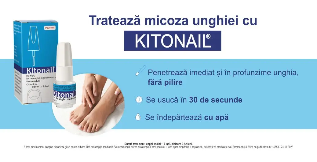 1038_X_531px_BANNER_static__KITONAIL